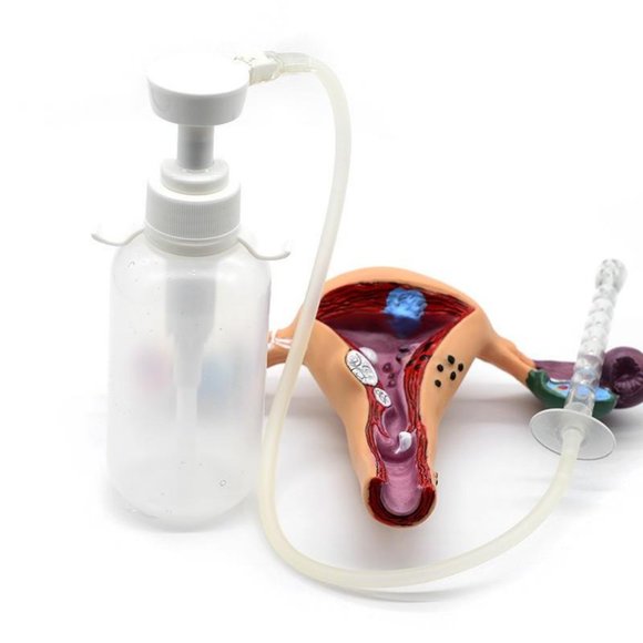 Vaginal Douche Cleaner Anal Douche Vagina Cleaning Kit 300 ml1 Full Kit - Picture 8 of 9